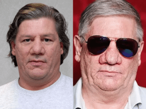 Claude -Ooliver Rudolph und seine unverwechselbare Nase: Fakten und Spekulationen! claude-oliver rudolph nase rosacea