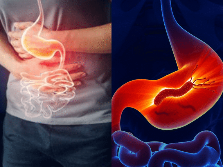 Helicobacter pylori ist ansteckend – Wie sich der Magenkeim verbreitet! helicobacter ansteckend