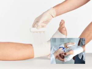 Zinkverband bei Entzündungen – Wirkung, Anwendung und schnelle Linderung! zinkverband bei entzündungen