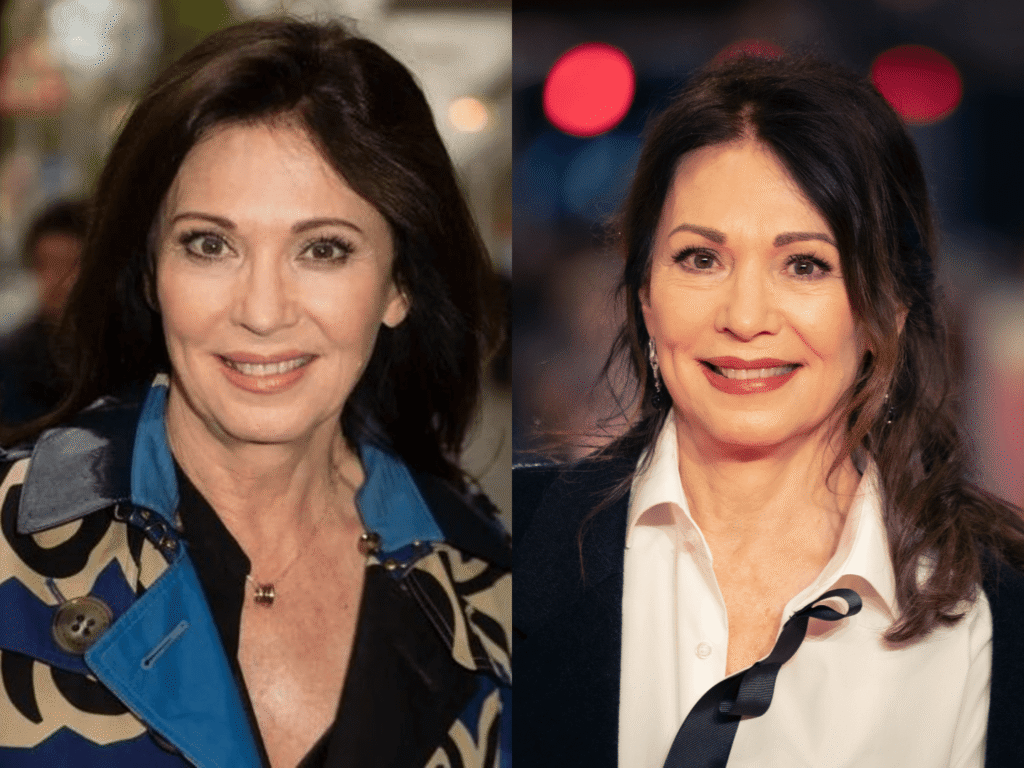 Iris Berben Schlaganfall – Die Wahrheit hinter dem Begriff! iris berben schlaganfall